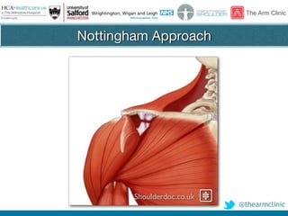 @thearmclinic
Nottingham Approach
Shoulderdoc.co.uk
 