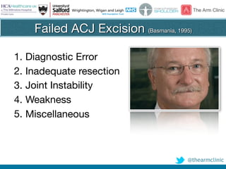 @thearmclinic
Failed ACJ Excision (Basmania, 1995)
1. Diagnostic Error

2. Inadequate resection

3. Joint Instability

4. Weakness

5. Miscellaneous
 