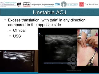 @thearmclinic
Unstable ACJ
• Excess translation ‘with pain’ in any direction,
compared to the opposite side

• Clinical

• USS
 
