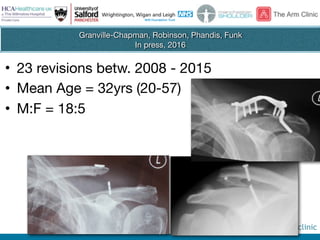 @thearmclinic
Granville-Chapman, Robinson, Phandis, Funk

In press, 2016
• 23 revisions betw. 2008 - 2015

• Mean Age = 32yrs (20-57)

• M:F = 18:5
 