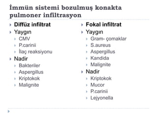 İmmün sistemi bozulmuş konakta
pulmoner infiltrasyon
   Diffüz infiltrat         Fokal infiltrat
   Yaygın                   Yaygın
       CMV                      Gram- çomaklar
       P.carinii                S.aureus
       Ġlaç reaksiyonu          Aspergillus
   Nadir                        Kandida
       Bakteriler               Malignite
       Aspergillus          Nadir
       Kriptokok                Kriptokok
       Malignite                Mucor
                                 P.carinii
                                 Lejyonella
 