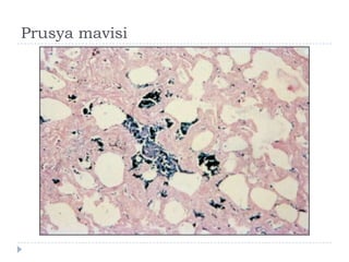 Prusya mavisi
 