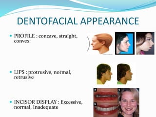 DENTOFACIAL APPEARANCE
 PROFILE : concave, straight,
convex
 LIPS : protrusive, normal,
retrusive
 INCISOR DISPLAY : Excessive,
normal, Inadequate
 