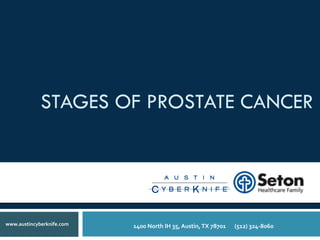 STAGES OF PROSTATE CANCER
1400	
  North	
  IH	
  35,	
  Austin,	
  TX	
  78701 	
  	
  	
  	
  	
  (512)	
  324-­‐8060	
  www.austincyberknife.com
 