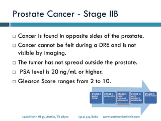 Prostate Cancer - Stage IIB
¨  Cancer is found in opposite sides of the prostate.
¨  Cancer cannot be felt during a DRE and is not
visible by imaging.
¨  The tumor has not spread outside the prostate.
¨  PSA level is 20 ng/mL or higher.
¨  Gleason Score ranges from 2 to 10.
1400	
  North	
  IH	
  35,	
  Austin,	
  TX	
  78701 	
   	
  (512)	
  324-­‐8060 	
  www.austincyberknife.com	
  
 
