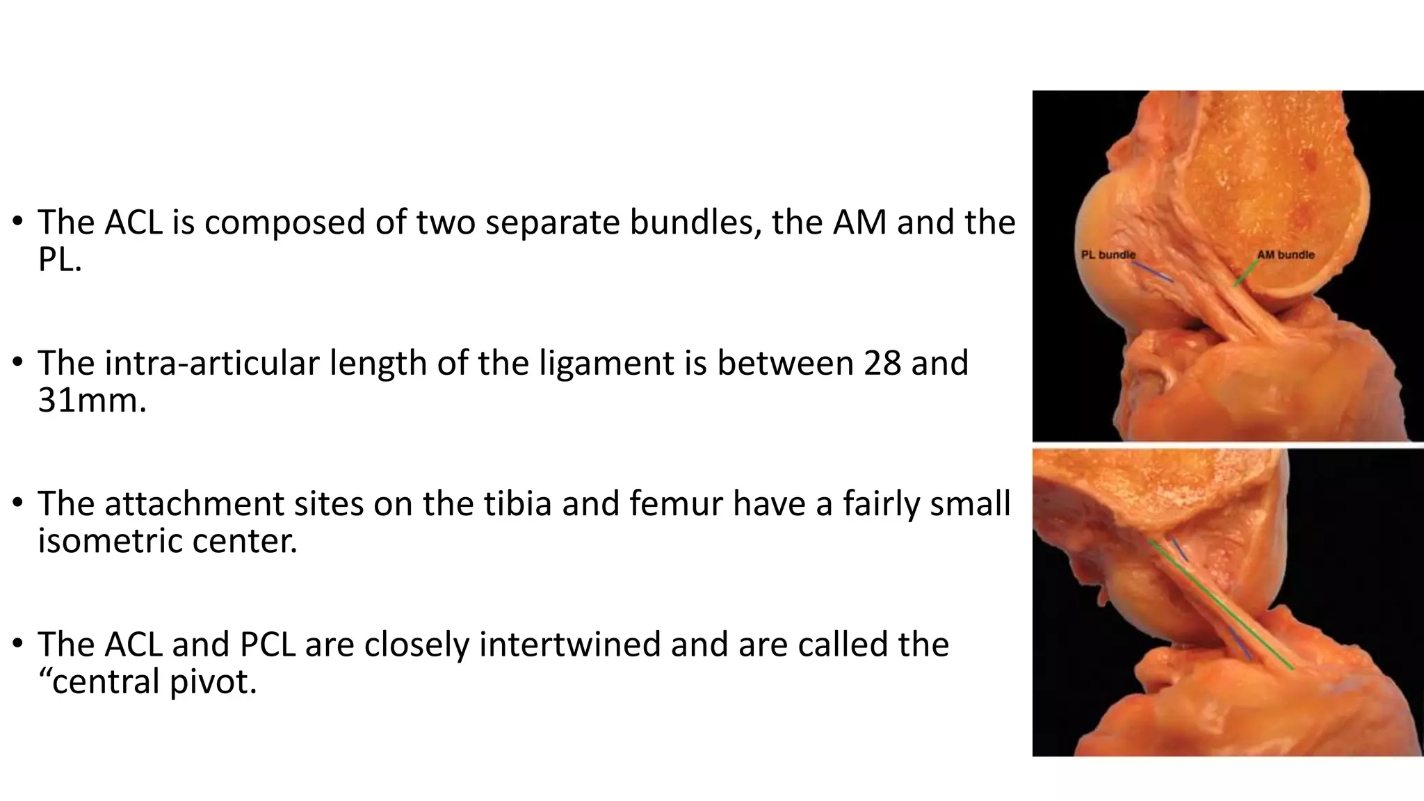 Anterior cruciate ligament injuries | PPTX