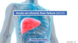 Acute-on-chronic liver failure (ACLF)
Pratap Sagar Tiwari
Total slides : 44
1
 