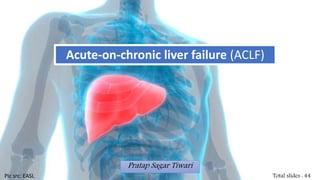 Acute-on-chronic liver failure (ACLF)
Pratap Sagar Tiwari
Total slides : 44Pic src: EASL
 
