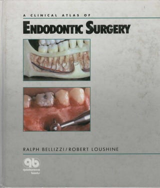 A clinical atlas of endodontic surgery by akramjuaim