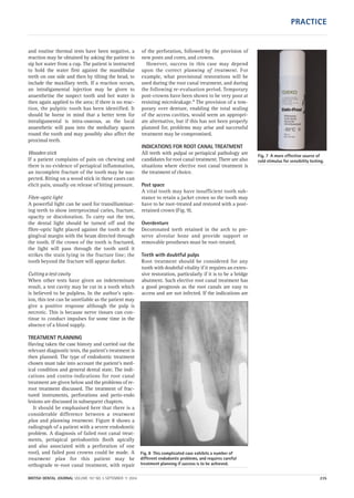 and routine thermal tests have been negative, a
reaction may be obtained by asking the patient to
sip hot water from a cup. The patient is instructed
to hold the water first against the mandibular
teeth on one side and then by tilting the head, to
include the maxillary teeth. If a reaction occurs,
an intraligamental injection may be given to
anaesthetise the suspect tooth and hot water is
then again applied to the area; if there is no reac-
tion, the pulpitic tooth has been identified. It
should be borne in mind that a better term for
intraligamental is intra-osseous, as the local
anaesthetic will pass into the medullary spaces
round the tooth and may possibly also affect the
proximal teeth.
Wooden stick
If a patient complains of pain on chewing and
there is no evidence of periapical inflammation,
an incomplete fracture of the tooth may be sus-
pected. Biting on a wood stick in these cases can
elicit pain, usually on release of biting pressure.
Fibre-optic light
A powerful light can be used for transilluminat-
ing teeth to show interproximal caries, fracture,
opacity or discoloration. To carry out the test,
the dental light should be turned off and the
fibre-optic light placed against the tooth at the
gingival margin with the beam directed through
the tooth. If the crown of the tooth is fractured,
the light will pass through the tooth until it
strikes the stain lying in the fracture line; the
tooth beyond the fracture will appear darker.
Cutting a test cavity
When other tests have given an indeterminate
result, a test cavity may be cut in a tooth which
is believed to be pulpless. In the author’s opin-
ion, this test can be unreliable as the patient may
give a positive response although the pulp is
necrotic. This is because nerve tissues can con-
tinue to conduct impulses for some time in the
absence of a blood supply.
TREATMENT PLANNING
Having taken the case history and carried out the
relevant diagnostic tests, the patient’s treatment is
then planned. The type of endodontic treatment
chosen must take into account the patient’s med-
ical condition and general dental state. The indi-
cations and contra-indications for root canal
treatment are given below and the problems of re-
root treatment discussed. The treatment of frac-
tured instruments, perforations and perio-endo
lesions are discussed in subsequent chapters.
It should be emphasised here that there is a
considerable difference between a treatment
plan and planning treatment. Figure 8 shows a
radiograph of a patient with a severe endodontic
problem. A diagnosis of failed root canal treat-
ments, periapical periodontitis (both apically
and also associated with a perforation of one
root), and failed post crowns could be made. A
treatment plan for this patient may be
orthograde re-root canal treatment, with repair
of the perforation, followed by the provision of
new posts and cores, and crowns.
However, success in this case may depend
upon the correct planning of treatment. For
example, what provisional restorations will be
used during the root canal treatment, and during
the following re-evaluation period. Temporary
post-crowns have been shown to be very poor at
resisting microleakage.4 The provision of a tem-
porary over denture, enabling the total sealing
of the access cavities, would seem an appropri-
ate alternative, but if this has not been properly
planned for, problems may arise and successful
treatment may be compromised.
INDICATIONS FOR ROOT CANAL TREATMENT
All teeth with pulpal or periapical pathology are
candidates for root canal treatment. There are also
situations where elective root canal treatment is
the treatment of choice.
Post space
A vital tooth may have insufficient tooth sub-
stance to retain a jacket crown so the tooth may
have to be root-treated and restored with a post-
retained crown (Fig. 9).
Overdenture
Decoronated teeth retained in the arch to pre-
serve alveolar bone and provide support or
removable prostheses must be root-treated.
Teeth with doubtful pulps
Root treatment should be considered for any
tooth with doubtful vitality if it requires an exten-
sive restoration, particularly if it is to be a bridge
abutment. Such elective root canal treatment has
a good prognosis as the root canals are easy to
access and are not infected. If the indications are
Fig. 7 A more effective source of
cold stimulus for sensibility testing.
Fig. 8 This complicated case exhibits a number of
different endodontic problems, and requires careful
treatment planning if success is to be achieved.
BRITISH DENTAL JOURNAL VOLUME 197 NO. 5 SEPTEMBER 11 2004 235
PRACTICE
05p231-238.qxd 12/08/2004 11:58 Page 235
 