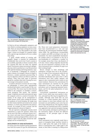 PRACTICE
BRITISH DENTAL JOURNAL VOLUME 197 NO. 8 OCTOBER 23 2004 457
be fitted on all new radiographic equipment, and
retro-fitted to existing equipment as soon as pos-
sible. There are many beam-aiming devices avail-
able to hold the x-ray film parallel to the tooth.
Figure 5 shows an example of a popular holder,
with a special cage attachment to fit over a rubber
dam clamp.
A quick, reliable method of viewing radi-
ographic images is essential for endodontics.
Considerable time can be lost if such a system is
not available, especially on those occasions when
the exposed film does not show the required
detail. Practitioners using conventional radiogra-
phy may wish to purchase an x-ray film processor
with rapid developing and fixing solutions, capa-
ble of producing a radiograph for viewing in
under a minute; an example is shown in Figure 6.
However, a modern automatic processor (Fig. 7)
may be adjusted to deliver wet films in under two
minutes. Films from both types of processor
should be carefully dried after viewing for accu-
rate storage in the patient’s records.
A modern alternative involves the use of digi-
tal radiography. A sensor plate, appropriately
sterilized and sealed, is used in place of the con-
ventional film. The sensor may be either directly
linked to the computer, or resemble a conven-
tional periapical film packet. The resultant
image is digitally processed and projected upon
the computer screen in a matter of seconds. The
quality of the image can be manipulated to
enable greater clarity when reading the picture.
For purposes of record keeping, the image may
be either dated, labelled and stored in the central
database, or a hard copy printed for the patient’s
records. An example of such a system, and the
images produced, is shown in Figure 8.
The pre-operative radiograph contains much
information to assist the operator, which may
not be seen if the film is carelessly viewed. An x-
ray viewer and some form of magnification are
needed to examine periapical films, and it is very
helpful if glare from the light around the radi-
ograph can be excluded (Fig. 9).
DEVELOPMENT OF HAND INSTRUMENTS
For many years the standard cutting instruments
have been the reamer, K-type file and Hedstroem
file. These root canal preparation instruments
have been manufactured to a size and type
advised by the International Standards Organi-
sation (ISO). The specifications recommended
are complex and differ according to the type of
instrument. For most standardized instruments
the number refers to its diameter at the tip in
one-hundredths of a millimetre; a number 10,
for example, means that it has a tip diameter of
0.10 mm. Colour coding originally denoted the
size, but now represents a sequence of sizes. All
these instruments have a standard 2% taper over
their working length.
Recent changes in both metallurgy and
endodontic concepts have led to the introduc-
tion of a range of new instruments which do not
conform to these specifications. These are
described individually later and in Part 7. These
instruments have been widely adopted, and
appear to give consistently better results in root
canal treatment. However, the conventional 2%
taper instruments are essential for the initial
exploration of most root canals, for difficult
procedures such as bypassing separated instru-
ments, and for the apical preparation of some
difficult canals.
Conventional ‘standardized’ instruments are
made of steel, which may wear quickly in den-
tine, and small size files may be regarded as dis-
posable. Although some hand files are now
available in a nickel–titanium alloy, which is
more resistant to wear than ordinary steel, the
increased cost and inability to pre-curve has not
led to their widespread use. The majority of these
modern files are manufactured with a modified
non-aggressive tip to prevent iatrogenic damage
to the canal system, and improve performance of
the instrument. Figure 10 shows the different
appearance of the principal types of these
instruments.
K-type file
These instruments were originally made from a
square or triangular blank, machine twisted to
form a tight spiral. The angle of the blades or
flutes is consequently near a right-angle to the
shank, so that either a reaming or a filing action
Fig. 7 An automatic radiographic processor, with a
simple device to bypass the drying cycle.
Fig. 8 An illustration of the
computer screen produced by digital
radiography, enabling immediate
viewing and manipulation of the
image The sensor plate or ‘film’ may
be either loose, resembling a
conventional periapical radiographic
film, which must be inserted into the
machine for processing, or linked by
cable to the processor as in b).
a b
Fig. 9 A radiographic viewer
designed to eliminate extraneous
light and magnify the image.
Fig. 10 Conventional hand
instruments; top – reamer with red
stop; middle - Hedstroem file with
black stop; bottom - K-flex file with
yellow stop.
08p455-464.qxd 22/09/2004 15:56 Page 457
 