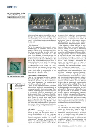 PRACTICE
460 BRITISH DENTAL JOURNAL VOLUME 197 NO. 8 OCTOBER 23 2004
followed or these delicate diamond tips may be
damaged. It is generally wise to use them with a
low power setting, and to ensure that they are in
contact with dentine before activating the piezo-
electric unit.
Canal preparation
The use of rotary cutting instruments in a stan-
dard handpiece is condemned because of the
danger of fracture of the instrument or perfora-
tion of the root canal. The exception to this rule
is the Gates–Glidden bur, which has a safe-
ended tip. In addition, the site of fracture, if it
does occur, is almost always near the hub so the
fractured piece is easily removed. In the past this
bur has been recommended for initial flaring of
the coronal portion of the canal. This may now
be carried out in a more controlled manner with
a nickel-titanium orifice shaper. The Gates–
Glidden bur may also be used to make post space
and to remove gutta-percha from the canal.
Gates–Glidden burs are manufactured in six
sizes; their use is described in Part 7.
Measurement of working length
There are two established methods of assessing
the working length of a root canal: one by radi-
ography and the other with the use of an elec-
tronic device apex locator (Fig. 16). Both meth-
ods will be described in Part 7.
Once the working length has been confirmed,
the individual preparation instruments must be
accurately marked to length accordingly. There
are many different gadgets available for transfer
of the working length; the author prefers the
device shown in Figure 17. There are also differ-
ent stops for the instrument, the most popular
being rubber or silicone stops. These should
always be placed at right angles to the shank of
the instrument. Ideally the stops should be either
notched, or pear shaped, so that in curved canals
the notch or point of the pear may be directed
towards the curve placed in the instrument.
Sterilization
Any instrument which is placed in the root canal
should be sterile, for two reasons. Firstly, to
prevent the introduction to the root canal sys-
tem of extraneous microorganisms, which may
severely compromise treatment, for example
pseudomonas.6 Secondly, if instruments and
devices were to be used on different patients, to
prevent cross-infection between patients. Bacte-
ria, viruses, fungi and prions may contaminate
instruments and research has shown that some
of these may not be destroyed by any method of
sterilization.7 Figure 18 illustrates this dramati-
cally. Concern has been raised over the steriliza-
tion of other items of dental equipment as well.8
Under the Medical Devices Directive, the man-
ufacturer of any dental instrument has an obli-
gation to inform the end-user (ie the dentist)
how their product should be decontaminated. It
is essential that this guidance is followed. What-
ever may be written in this and other texts may
be superseded at any time. Dentists should
therefore ensure that they are familiar with and
conform to the manufacturer’s instructions. At
present, some endodontic instruments are
marked with the symbol shown in Figure 19
indicating that they are single use instruments.
It is assumed that all manufacturers will shortly
follow this Medical Devices Directive.
It may, however, be necessary to sterilize
instruments for further treatment of the same
patient on a subsequent occasion when cross-
infection control would not be a problem. After
use, instruments must be cleaned as soon as pos-
sible to remove debris which harbours and pro-
tects microorganisms. Cleaning is carried out by
scrubbing in warm water and detergent, although
the debris may be first removed from most root
canal instruments by stabbing them into a
sponge. The best method of cleaning is to place
the instruments into an ultrasonic bath. The cavi-
tational effects of ultrasonics will dislodge debris
from places which are inaccessible to normal
cleaning. When the instruments are clean they
must be sterilized in an autoclave. Microorgan-
isms are destroyed at lower temperatures and in a
shorter period in moist heat as all biological reac-
tions are catalysed in water. The disadvantages of
autoclaving are that metal instruments tend to
corrode and sharp instruments are dulled.
Barbed broach
This instrument has sharp rasps pointing
towards the handle. They may be used to
remove the contents of the root canal before
commencing shaping procedures. A vital pulp
may be extirpated when carrying out elective
endodontic procedures, or when treating a tooth
with an irreversible pulpitis, by introducing the
barbed broach deep in the canal, twisting it a
quarter to a half turn, and withdrawing, as
shown in Figure 20.
Fig. 16 An electronic apex locator.
Fig. 17 A device for
setting instruments
at the correct
working length
Fig. 15 (a) CPR® ultrasonic tips, now
available to fit different piezo-
electronic machines. (b) Also shown
are KiS tips for periradicular surgery.
a b
08p455-464.qxd 22/09/2004 10:28 Page 460
 