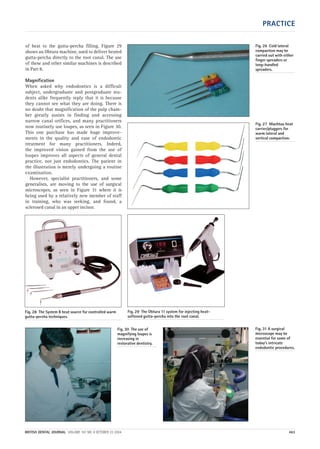 PRACTICE
BRITISH DENTAL JOURNAL VOLUME 197 NO. 8 OCTOBER 23 2004 463
of heat to the gutta-percha filling. Figure 29
shows an Obtura machine, used to deliver heated
gutta-percha directly to the root canal. The use
of these and other similar machines is described
in Part 8.
Magnification
When asked why endodontics is a difficult
subject, undergraduate and postgraduate stu-
dents alike frequently reply that it is because
they cannot see what they are doing. There is
no doubt that magnification of the pulp cham-
ber greatly assists in finding and accessing
narrow canal orifices, and many practitioners
now routinely use loupes, as seen in Figure 30.
This one purchase has made huge improve-
ments in the quality and ease of endodontic
treatment for many practitioners. Indeed,
the improved vision gained from the use of
loupes improves all aspects of general dental
practice, not just endodontics. The patient in
the illustration is merely undergoing a routine
examination.
However, specialist practitioners, and some
generalists, are moving to the use of surgical
microscopes, as seen in Figure 31 where it is
being used by a relatively new member of staff
in training, who was seeking, and found, a
sclerosed canal in an upper incisor.
Fig. 26 Cold lateral
compaction may be
carried out with either
finger spreaders or
long-handled
spreaders.
Fig. 28 The System B heat source for controlled warm
gutta-percha techniques.
Fig. 29 The Obtura 11 system for injecting heat-
softened gutta-percha into the root canal.
Fig. 27 Machtou heat
carrier/pluggers for
warm lateral and
vertical compaction.
Fig. 30 The use of
magnifying loupes is
increasing in
restorative dentistry.
Fig. 31 A surgical
microscope may be
essential for some of
today’s intricate
endodontic procedures.
08p455-464.qxd 22/09/2004 10:32 Page 463
 