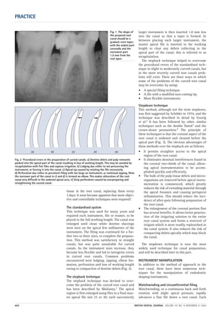 tissue in the root canal, replacing them every
3 days. It soon became apparent that more objec-
tive and controllable techniques were required!
The standardised system
This technique was used for many years and
required each instrument, file or reamer, to be
placed to the full working length. The canal was
enlarged until clean white dentine shavings
were seen on the apical few millimetres of the
instrument. The filing was continued for a fur-
ther two or three sizes, to complete the prepara-
tion. This method was satisfactory in straight
canals, but was quite unsuitable for curved
canals. As the instrument sizes increase, they
become less flexible and led to iatrogenic errors
in curved root canals. Common problems
encountered were ledging, zipping, elbow for-
mation, perforation and loss of working length
owing to compaction of dentine debris (Fig. 2).
The stepback technique
The stepback technique was devised to over-
come the problem of the curved root canal and
has been described by Mullaney.1 The apical
region is first enlarged using files to a final mas-
ter apical file size 25 or 30; each successively
larger instrument is then inserted 1.0 mm less
into the canal so that a taper is formed. In
between placing each larger instrument, the
master apical file is inserted to the working
length to clear any debris collecting in the
apical part of the canal; this is referred to as
recapitulation.
The stepback technique helped to overcome
the procedural errors of the standardised tech-
nique in slight to moderately curved canals, but
in the more severely curved root canals prob-
lems still exist. There are three ways in which
some of the problems of the curved root canal
may be overcome, by using:
• A special filing technique.
• A file with a modified non-cutting tip.
• More flexible instruments.
Stepdown technique
This method, although not the term stepdown,
was first suggested by Schilder in 1974, and the
technique was described in detail by Goerig
et al.2 It has been followed by other, similar
techniques such as the double flared3 and the
crown-down pressureless.4 The principle of
these techniques is that the coronal aspect of the
root canal is widened and cleaned before the
apical part (Fig. 3). The obvious advantages of
these methods over the stepback are as follows.
• It permits straighter access to the apical
region of the root canal.
• It eliminates dentinal interferences found in
the coronal two-thirds of the canal, allow-
ing apical instrumentation to be accom-
plished quickly and efficiently.
• The bulk of the pulp tissue debris and micro-
organisms are removed before apical instru-
mentation is commenced, which greatly
reduces the risk of extruding material through
the apical foramen and causing periapical
inflammation. This should reduce the inci-
dence of after-pain following preparation of
the root canal.
• The enlargement of the coronal portion first
has several benefits. It allows better penetra-
tion of the irrigating solution to the entire
root canal system and forms a reservoir of
irrigant which is more readily replenished in
the canal system. It also reduces the risk of
compacting debris apically which may block
the canal.
The stepdown technique is now the most
widely used technique for canal preparation,
and will be described later in this part.
INSTRUMENT MANIPULATION
In addition to the method of approach to the
root canal, there have been numerous tech-
niques for the manipulation of endodontic
shaping instruments.
Watchwinding and circumferential filing
Watchwinding, or a continuous back and forth
rotation with slight apical pressure, rapidly
advances a fine file down a root canal. Each
PRACTICE
604 BRITISH DENTAL JOURNAL VOLUME 197 NO. 10 NOVEMBER 27 2004
Fig. 1 The shape of
the prepared root
canal should be a
gradual, even taper,
with the widest part
coronally and the
narrowest part
1.0 mm from the
root apex.
Fig. 2 Procedural errors in the preparation of curved canals. a) Dentine debris and pulp remnants
packed into the apical part of the canal resulting in loss of working length. This may be avoided by
recapitulation with fine files and copious irrigation. b) Ledging due either to not precurving the
instrument, or forcing it into the canal. c) Apical zip caused by rotating the file excessively.
d) Perforation due either to persistent filing with too large an instrument, or continual zipping. Note
the narrower part of the canal in c) and d) is termed an elbow. This makes obturation of the root
canal very difficult in the widened apical area. e) Strip perforation caused by overpreparing and
straightening the curved canal.
(a) (b) (c) (d) (e)
10p603-613.qxd 26/10/2004 14:55 Page 604
 