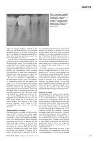 slight turn engages the flutes of the file in the
canal wall and removes dentine. Only fine files
should be advanced to the apex in this way as
there is a danger of compacting pulpal debris
ahead of the file. If such a blockage occurs it can
be extremely difficult to remove.
Once the file has reached the desired length, a
push-pull filing action was used, moving the file
circumferentially around the canal walls. When
using K-type files an attempt was made to file on
the outstroke only, again to reduce the apical
compaction of debris. Hedstroem files were more
efficient for circumferential filing, although
these should not be used when watchwinding.
Research into canal preparation found two
distinct problems with circumferential filing.
The first was a tendency to preferentially file
the inside wall of a curved canal. The technique
of anticurvature filing was put forward by
Abou-Rass et al.5 Anticurvature filing involves
filing predominantly away from the inner curve
of a root to reduce the risk of a strip perforation.
The mesiobuccal roots of maxillary molars and
the mesial roots of mandibular molars are the
teeth most frequently at risk. The method is used
only in canals with a moderate-to-severe curve.
The second finding was that once the file
engaged in the coronal part of the root canal, the
apical flutes tended not to cut dentine but
remain passive. The majority of the filing
occurred coronally, which tended to leave
underprepared canals which were not fully
cleaned.
The balanced force technique
The balanced force technique, first described by
Roane et al.,6 is now the most widely taught
technique for manipulating handfiles. It is par-
ticularly good when negotiating the curved root
canal. The technique requires flexible files with
non-cutting tips. The file is inserted into the
canal until slight resistance is felt and then
rotated 60° clockwise to engage the flutes into
the dentine. If a greater movement is made,
iatrogenic problems can quickly arise. Using
light apical finger pressure to hold the file at
exactly the same depth in the canal, the file is
now rotated through 360° in an anticlockwise
direction. The first 60° of this turn cuts off the
dentine engaged in the flutes of the file, and the
remainder of the movement picks up this den-
tine in the flutes of the file prior to the next
cycle. The amount of apical pressure required to
rotate the file anticlockwise is just sufficient to
prevent it from winding out of the canal. Watch-
ing the rubber stop in relation to the tooth assists
in keeping the file steady with no in or out
movement.
If the file is engaged too far into dentine with
the first clockwise movement, ie if the turn is
greater than 60°, excessive force is applied to the
file during the cutting phase, and the file may
fracture. The balanced force cycle of movement
should be made no more than three times before
the file is withdrawn to be cleaned, ideally by
pressing it into a sterile sponge. The root canal
system should be irrigated copiously before the
file is reintroduced. Using this method, curved
canals may be prepared to the full working
length without producing apical transportation.
Ultrasonic technique
Ultrasound has been used to activate specially
designed endodontic files. Ultrasound consists
of acoustic waves which have a frequency high-
er than can be perceived by a human ear. The
acoustic energy is transmitted to the root canal
instrument, which oscillates at 20–40,000 cycles
per second, depending on which unit is used.
The superior cleaning effect is achieved by
acoustic streaming of the irrigant and not, as
originally thought, by cavitation.7 Irrigation
with sodium hypochlorite is necessary,8 although
some of the ultrasonic units are not designed to
accept sodium hypochlorite through the system
and, if water is used, they will be less efficient in
their cleansing effect. Even when units designed
to take sodium hypochlorite are used, daily
maintenance must be carried out to prevent
damage, particularly to metals, because the
irrigant is corrosive.
The irrigant passes down the shank of the
instrument and into the root canal, producing a
continuous and most efficient system. Acoustic
PRACTICE
BRITISH DENTAL JOURNAL VOLUME 197 NO. 10 NOVEMBER 27 2004 605
Fig. 3 The root canal in this tooth
contains necrotic infected debris.
The objective in endodontics is to
remove the debris without
extruding any through the apical
foramen. It makes good sense to
use a technique which cleans the
coronal part first and then the
apical portion.
10p603-613.qxd 26/10/2004 14:55 Page 605
 