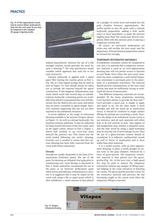 PRACTICE
612 BRITISH DENTAL JOURNAL VOLUME 197 NO. 10 NOVEMBER 27 2004
sodium hypochlorite, whereas the use of a full
strength solution would preclude the need for
such a dressing.22 The wise practitioner would
consider which approach best suits his or her
style of practice.
Calcium hydroxide is applied with a spiral
paste filler (noting the caution given at Part 5,
Fig. 20), or a fine-tipped syringe may be used as
seen in Figure 14. Care should always be taken
not to extrude the material beyond the apical
constriction. If this happens, inflammation may
result which could take several days to subside.
Calcium hydroxide containing points are avail-
able from which it is postulated that ions will dis-
sociate into the fluid in the root canal, and which
may be better controlled in apical length. How-
ever, research supporting this has not yet been
reported in the endodontic literature.
A recent addition to the range of intracanal
dressing available is the mixture Vitapex, shown
at Figure 15. As well as calcium hydroxide, the
material contains iodoform. It may be indicated
for deep-seated infections of the root canal, such
as the upper canine, shown in Part 2, Figure 1,
which had resulted in an extra-oral sinus
beneath the patient’s eye. This closed and the
tooth healed following one week’s dressing.
Extreme care is needed to ensure that this vis-
cous dressing has been fully removed from the
canal walls before obturation.
Steroids
Steroids are readily obtainable in the form of tri-
amcinalone (Ledermix paste). The use of the
paste for dressing an inflamed vital pulp prior to
commencing root canal therapy is discussed in
Part 3. Some authorities recommend the use of
the paste as an intervisit medicament paste
when severe periradicular inflammation is pres-
ent. It is suggested that it may be wiped on the
canal wall using a file or paper point which is
then withdrawn; a small amount is then placed
on a pledget of cotton wool and sealed into the
pulp chamber between appointments. The
author prefers to mix the paste with a calcium
hydroxide preparation, adding a little sterile
water or local anaesthetic to make the mixture
slightly more fluid. The canals may then be com-
pletely filled with this mixture prior to placing a
temporary coronal seal.
Of course, no intracanal medicament yet
exists that will sterilise the root canal, and the
importance of biomechanical preparation cannot
be stressed too strongly.
TEMPORARY RESTORATIVE MATERIALS
If endodontic treatment cannot be completed in
one visit, it is essential that a temporary restora-
tive material is used as an inter-appointment
dressing that will not permit access to bacteria
or oral fluids. Even when the root canal treat-
ment has been completed, a well-sealed tempo-
rary restoration is necessary prior to the place-
ment of a permanent restoration. The material
should prevent contamination of the root canal
system and must be sufficiently strong to with-
stand the forces of mastication.
Two different temporary materials are recom-
mended. Of the many proprietary materials,
Cavit has been shown to provide the best seal.23
Cavit provides a good seal, is simple to apply
and quick to set. On the other hand, it lacks
strength and will not stand up to masticatory
forces. It should be confined to single surface
fillings for periods not exceeding a week. How-
ever, the shape of an endodontic access cavity is
not retentive, and all such materials will either
leak or be lost entirely in time. Any ingress of
microorganisms may reinfect a prepared canal,
and the time saved by using a rapid technique
may be severely lost if such leakage occurs. Thus
the use of a glass-ionomer cement should be
considered. It is adhesive, antibacterial, stands
up well to forces of mastication and is more
stable than other materials.
It is a useful routine, with an inter-appoint-
ment dressing, to place a sterile pledget of cot-
ton wool in the pulp chamber, followed by a
layer of gutta-percha. The temporary restora-
tive material is then placed over the gutta-
percha (Fig. 16). At the next visit, a high-speed
bur may be used to remove the temporary
restoration without any danger of filling mate-
rial lodging in the canal entrances or blocking
the canals. The gutta-percha provides a base for
the restorative material and prevents the bur
becoming caught in the cotton wool when the
temporary filling is removed.
Fig. 15 Vitapex
intracanal dressing.
Fig. 14 A fine tipped plastic canula
may be used to deliver medicaments
deep into the root canal. Its size may
be compared to the standard
28-gauge irrigating needle.
10p603-613.qxd 26/10/2004 15:01 Page 612
 