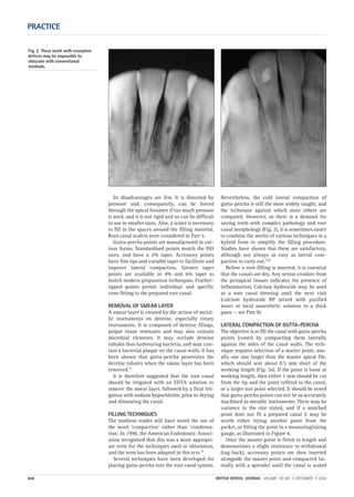 Its disadvantages are few. It is distorted by
pressure and, consequently, can be forced
through the apical foramen if too much pressure
is used, and it is not rigid and so can be difficult
to use in smaller sizes. Also, a sealer is necessary
to fill in the spaces around the filling material.
Root canal scalers were considered in Part 5.
Gutta-percha points are manufactured in var-
ious forms. Standardised points match the ISO
sizes, and have a 2% taper. Accessory points
have fine tips and variable taper to facilitate and
improve lateral compaction. Greater taper
points are available in 4% and 6% taper to
match modern preparation techniques. Feather-
tipped points permit individual and specific
cone fitting to the prepared root canal.
REMOVAL OF SMEAR LAYER
A smear layer is created by the action of metal-
lic instruments on dentine, especially rotary
instruments. It is composed of dentine filings,
pulpal tissue remnants and may also contain
microbial elements. It may occlude dentine
tubules thus harbouring bacteria, and may con-
tain a bacterial plaque on the canal walls. It has
been shown that gutta-percha penetrates the
dentine tubules when the smear layer has been
removed.3
It is therefore suggested that the root canal
should be irrigated with an EDTA solution to
remove the smear layer, followed by a final irri-
gation with sodium hypochlorite, prior to drying
and obturating the canal.
FILLING TECHNIQUES
The studious reader will have noted the use of
the word ‘compaction’ rather than ‘condensa-
tion’. In 1998, the American Endodontic Associ-
ation recognised that this was a more appropri-
ate term for the techniques used in obturation,
and the term has been adopted in this text.4
Several techniques have been developed for
placing gutta-percha into the root canal system.
Nevertheless, the cold lateral compaction of
gutta-percha is still the most widely taught, and
the technique against which most others are
compared. However, as there is a demand for
saving teeth with complex pathology and root
canal morphology (Fig. 2), it is sometimes easier
to combine the merits of various techniques in a
hybrid form to simplify the filling procedure.
Studies have shown that these are satisfactory,
although not always as easy as lateral com-
paction to carry out.5,6
Before a root-filling is inserted, it is essential
that the canals are dry. Any serous exudate from
the periapical tissues indicates the presence of
inflammation. Calcium hydroxide may be used
as a root canal dressing until the next visit
(calcium hydroxide BP mixed with purified
water or local anaesthetic solution to a thick
paste — see Part 9).
LATERAL COMPACTION OF GUTTA-PERCHA
The objective is to fill the canal with gutta-percha
points (cones) by compacting them laterally
against the sides of the canal walls. The tech-
nique requires selection of a master point, usu-
ally one size larger than the master apical file,
which should seat about 0.5 mm short of the
working length (Fig. 3a). If the point is loose at
working length, then either 1 mm should be cut
from the tip and the point refitted to the canal,
or a larger size point selected. It should be noted
that gutta-percha points can not be as accurately
machined as metallic instruments. There may be
variance in the size stated, and if a matched
point does not fit a prepared canal it may be
worth either trying another point from the
packet, or fitting the point in a measuring/sizing
gauge, as illustrated in Figure 4.
Once the master point is fitted to length and
demonstrates a slight resistance to withdrawal
(tug-back), accessory points are then inserted
alongside the master point and compacted lat-
erally with a spreader until the canal is sealed
PRACTICE
668 BRITISH DENTAL JOURNAL VOLUME 197 NO. 11 DECEMBER 11 2004
Fig. 2 These teeth with resorptive
defects may be impossible to
obturate with conventional
methods.
11p667-672.qxd 09/11/2004 14:07 Page 668
 