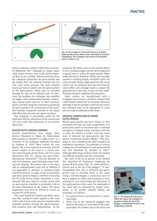 Fig. 11 The System-B heat source.
When the ring on the handpiece is
pressed as shown the tip of the
plugger is immediately heated to the
temperature selected.
PRACTICE
BRITISH DENTAL JOURNAL VOLUME 197 NO. 11 DECEMBER 11 2004 671
driven compactor, which is effectively an invert-
ed Hedstroem file.7 Although no longer made,
other similar devices, such as the gutta conden-
sor (Fig. 9), are available. The frictional heat from
the compactor plasticises the gutta-percha and
the blades drive the softened material into the
root canal under pressure. The main problem
found was lack of control over the apical portion
of the gutta-percha, which may be extruded
through the apex in its softened state. To over-
come this problem, the technique was modified
by Tagger, who recommended laterally condens-
ing a master point and two or three accessory
points, and then using the condensor to plasticise
the gutta-percha in the coronal part of the canal.8
The laterally compacted material in the apical
half effectively prevents any apical extrusion.
The technique is particularly useful for the
rapid and effective obturation of the coronal part
of a root canal after placement of an accurate
apical seal.
HEATED GUTTA-PERCHA CARRIERS
Several manufacturers now supply these
devices, illustrated in Figure 10. Alpha-phase
gutta-percha is attached to a rigid carrier, in a
variation of the technique originally described
by Johnson in 1978.9 Most carriers are now
plastic. The excess material is removed, and the
carrier remains in the canal as a central core.
The softened gutta-percha flows well in to canal
aberrations, fins, etc., giving very good three-
dimensional obturation.10 Success depends, as
with all techniques, upon thorough canal clean-
ing and shaping. The carriers have a 4% taper,
and an underprepared canal will be difficult if
not impossible to obturate to working length
with these devices. A range of sizes is presented,
and most systems employ a method of ensuring
the fit of the device before obturation is com-
menced. This may either be a blank carrier with
no gutta-percha attached, or preferably a file of
the same dimensions as the carrier. The apical
preparation may then be refined to ensure an
accurate fit of the device.
The canal should be cleaned and dried, and a
very fine coating of sealer applied to the canal
orifice only. Excess sealer may be extruded under
hydraulic pressure through the apical foramen,
with resultant pain and inflammation. In the
meantime the rubber stop on the selected device
is set to working length, and the device placed in
a special oven to soften the gutta-percha. When
ready, the device should be swiftly and smoothly
inserted to working length, and held in place for
a few seconds. Using a high-speed bur the excess
carrier may be sectioned and removed from the
canal orifice, and a plugger used to compact the
gutta-percha in this area. A layer of resin-modi-
fied glass ionomer completes the obturation.
Some carriers are manufactured with a
U-shaped cross-section to facilitate removal with
a drill should retreatment be necessary. However,
although it may be possible to drill out the carrier,
this technique may not be appropriate if a post
and core may be indicated in the future.
VERTICAL COMPACTION OF WARM
GUTTA-PERCHA
Heated gutta-percha has been shown to flow
extremely well into all canal irregularities. It is
particularly useful in situations such as internal
resorption, C-shaped canals, and those with fins
or webs. As referred to earlier, when the smear
layer is removed the gutta-percha has been
shown to penetrate dentine tubules.3 This tech-
nique is now considered the gold standard for
endodontic obturation. The principle of vertical
compaction of increments of warm gutta-percha
was first described by Schilder in 1967.11
Although delivering excellent results, the method
was difficult to master and time-consuming.
The state of the art at present is the method
first described by Buchanan employing the
System-B heat source (Fig. 11), which delivers a
precise heat to the tip of the plugger.12 A non-
standardised (4%, 6% or feathered tip) gutta-
percha cone is carefully fitted to the canal.
Using a selected plugger, a continuous wave of
heat is applied to soften and downpack a cone,
resulting in very well-compacted obturation of
the apical portion of the canal. The remainder of
the canal may be obturated by further incre-
ments, or by another method. Briefly, the
technique is as follows.
1. Fit a gutta-percha cone and mark it at work-
ing length.
2. Select one of the System-B pluggers that
binds in the canal 5–7 mm short of the work-
ing length. Set a rubber stop at this level, and
Fig. 10 An example of a Thermafil device a), a heated
gutta-percha carrier, with an oven necessary for accurate
softening b). The U-shaped cross-section of the plastic
carrier is shown in c).
a
c
b
11p667-672.qxd 09/11/2004 14:10 Page 671
 