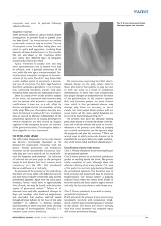 PRACTICE
BRITISH DENTAL JOURNAL VOLUME 197 NO. 12 DECEMBER 25 2004 741
resorption may occur in patients following
radiation therapy.
Idiopathic resorption
There are many reports of cases in which, despite
investigation, no possible local or general cause
has been found. The resorption may be confined
to one tooth, or several may be involved. The rate
of resorption varies from slow, taking place over
years, to quick and aggressive, involving large
amounts of tissue destruction over a few months.
The site and shape of the resorption defect
also varies. Two different types of idiopathic
resorption have been described.
Apical resorption is usually slow and may
arrest spontaneously; one or several teeth may
be affected, with a gradual shortening of the
root, while the root apex remains rounded. Cer-
vical external resorption takes place in the cervi-
cal area of the tooth. The defect may form either
a wide, shallow crater or, conversely, a burrow-
ing type of resorption. This latter type has been
described variously as peripheral cervical resorp-
tion, burrowing resorption, pseudo pink spot,
resorption extra camerale and extracanal invasive.
There is a small defect on the external surface
of the tooth; the resorption then burrows deep
into the dentine with extensive tunnel-shaped
ramifications. It does not, as a rule, affect the
dentine and predentine in the immediate vicinity
of the pulp. This type of resorption is easily mis-
taken for internal resorption. Cervical resorption
may be caused by chronic inflammation of the
periodontal ligament or by trauma. Both types of
cervical resorption are best treated by surgical
exposure of the resorption lacunae and removal
of the granulation tissue. The resorptive defect is
then shaped to receive a restoration.
THE PERIO-ENDO LESION
The differential diagnosis of perio-endo lesions
has become increasingly important as the
demand for complicated restorative work has
grown. Neither periodontic nor endodontic
treatment can be considered in isolation as clini-
cally they are closely related and this must influ-
ence the diagnosis and treatment. The influence
of infected and necrotic pulp on the periapical
tissues is well known, but there remains much
controversy over the effect that periodontal
disease could have on a vital pulp.
Examination of the anatomy of the tooth shows
that there are many paths to be taken by bacteria
and their toxic products between the pulp and the
periodontal ligament. Apart from the main apical
foramina, lateral canals exist in approximately
50% of teeth, and may be found in the furcation
region of permanent molars.23 Seltzer et al.
observed inter-radicular periodontal changes in
dogs and monkeys after inducing pulpotomies
and concluded that noxious material passed
through dentinal tubules in the floor of the pulp
chamber.24 In addition to dentinal tubules,
microfractures are often present in teeth, allowing
the passage of microorganisms. Clinically, it is
common to see cervical sensitivity.
The controversy concerning the effect of peri-
odontal disease on the pulp ranges between
those who believe that pulpitis or pulp necrosis
or both can occur as a result of periodontal
inflammation, to those who state categorically
that pulpal changes are independent of the status
of the periodontium. In the author’s opinion,
Belk and Gutmann present the most rational
view, which is that periodontal disease may
damage pulp tissue via accessory or lateral
canals, but total pulpal disintegration will not
occur unless all the main apical foramina are
involved by bacterial plaque (Fig. 9).25
The problem that faces the clinician treating
perio-endo lesions is to assess the extent of the dis-
ease and to decide whether the tooth or the peri-
odontium is the primary cause. Only by carrying
out a careful examination can the operator judge
the prognosis and plan the treatment.26 There are
several ways in which perio-endo lesions can be
classified; the one given below is a slight modifica-
tion of the Simon, Glick and Frank classification.27
Classification of perio-endo lesions
Class 1. Primary endodontic lesion draining through
the periodontal ligament
Class l lesions present as an isolated periodontal
pocket or swelling beside the tooth. The patient
rarely complains of pain, although there will
often be a history of an acute episode. The cause
of the pocket is a necrotic pulp draining through
the periodontal ligament. The furcation area of
both premolar and molar teeth may be involved.
Diagnostically, one should suspect a pulpally
induced lesion when the crestal bone levels on
both the mesial and distal aspects appear normal
and only the furcation shows a radiolucent area.
Class 2. Primary endodontic lesion with secondary
periodontal involvement
If left untreated, the primary lesion may become
secondarily involved with periodontal break-
down. A probe may encounter plaque or calculus
in the pocket. The lesion will resolve partially
with root canal treatment but complete repair
will involve periodontal therapy.
Fig. 9 A severe endo-perio lesion
that may require root resection
12p735-743.qxd 19/11/2004 11:46 Page 741
 