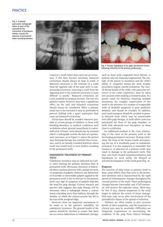 conserve a tooth rather than carry out an extrac-
tion, if this does become necessary, balanced
extractions should always be kept in mind. A
balanced extraction is the removal of a tooth
from the opposite side of the same arch. A com-
pensating extraction, removing a tooth from the
opposing arch to the enforced extraction is more
difficult to justify.1 Balanced extractions are
rarely justified for primary incisors. The loss of a
primary canine, however, may have a significant
effect on the arch and balanced extractions
should always be considered. When a primary
molar has to be extracted it may be preferable to
prevent drifting with a space maintainer than
carry out balanced extractions.
Extractions should be avoided wherever pos-
sible in certain groups of children; ie those with
bleeding disorders, or medical conditions such
as diabetes where general anaesthesia is contra-
indicated. Primary teeth should also be retained
where a radiograph reveals the lack of a perma-
nent successor, as in Figure 3, where the patient
may find pulp therapy less stressful than extrac-
tion, and in an already crowded dentition where
tooth loss would lead to even further crowding
of the permanent teeth.
ENDODONTIC TREATMENT OF PRIMARY
TEETH
Endodontic treatment may be indicated far earli-
er when treating the primary dentition than in
permanent teeth. Obviously, treatment is indicat-
ed when a patient presents with a pulpal necrosis,
or symptoms of pulpitis. However, the distinction
of reversible or irreversible pulpitis applied to the
permanent teeth is not so relevant in the primary
teeth; any sign or symptom of pulpitis indicates
the need for pulp therapy. Current research and
practice also suggests that pulp therapy will be
necessary when a radiograph shows a carious
lesion extending more than halfway through the
dentine, or where the carious process has led to
the loss of the marginal ridge.
However, there are important assessments to
be made as to the patient’s suitability for
endodontic treatment. The general health of the
patient should be checked to ensure that there
are no contra-indications to endodontic therapy,
such as those with congenital heart disease, or
patients who are immunocompromised. The atti-
tude of the parent to treatment and the child’s
ability to cooperate during the more lengthy
procedures require careful evaluation. The over-
all dental health of the child, with particular ref-
erence to the caries experience, must be taken
into account when making a treatment plan. In a
poorly cared for dentition requiring multiple
treatments, the complex conservation of one
tooth in the presence of a number of comparable
teeth of doubtful prognosis is poor paediatric
dentistry and should be avoided. In addition,
root canal treatment should be avoided in gross-
ly decayed teeth which may be unrestorable
even after pulp therapy; in teeth where caries has
penetrated the floor of the pulp chamber; in
teeth with advanced root resorption, or those
close to exfoliation.
An additional problem is the close relation-
ship of the roots of the primary teeth to the
developing permanent successor. During exfoli-
ation, the roots of the former resorb, necessitat-
ing the use of a resorbable paste in endodontic
treatment. It is also important to remember that
trauma to, or infection of, a primary tooth, may
result in damage to the permanent tooth. This
may vary from enamel hypomineralisation and
hypoplasia to, more rarely, the delayed or
arrested development of the tooth germ (Fig. 4).
Diagnosis
The reaction of pulp tissue in primary teeth to
deep caries differs from that seen in the perma-
nent dentition and is characterised by the rapid
spread of inflammatory changes throughout the
coronal portion of the tooth. These pathological
changes become irreversible and, if left untreat-
ed, will involve the radicular tissue. There may
be few, if any, clinical symptoms in the early
stages to indicate the extent of tissue damage.
Pain may only occur after involvement of the
periradicular tissues in the spread of infection.
Children are often unable to give accurate
details of their symptoms, and the responses to
clinical tests may be unreliable. Difficulties are
frequently experienced in ascertaining the
condition of the pulp from clinical findings.
PRACTICE
Fig. 3 A dental
panoramic tomograph
taken as part of the
assessment for
extraction of deciduous
molars, reveals the
absence of permanent
lower second premolars.
Fig. 4 Enamel hypoplasia of an upper permanent incisor
following infection of the primary predecessor.
10 BRITISH DENTAL JOURNAL VOLUME 198 NO. 1 JANUARY 8 2005
Endo_Chapter_10.qxd 10/12/2004 14:02 Page 10
 