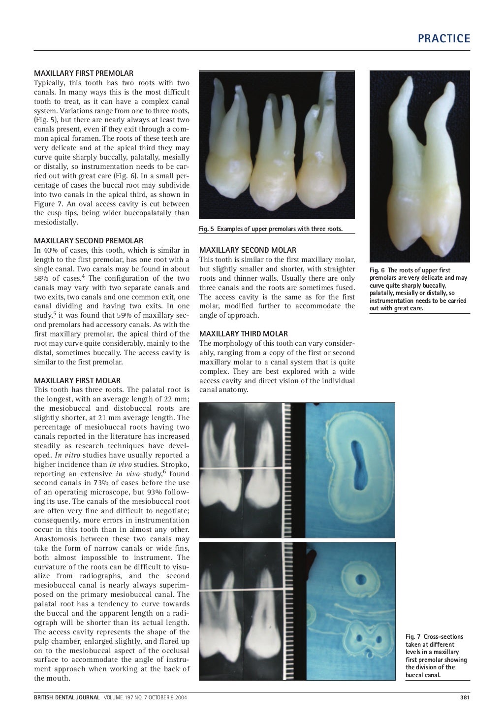 A clinical guide to endodontics
