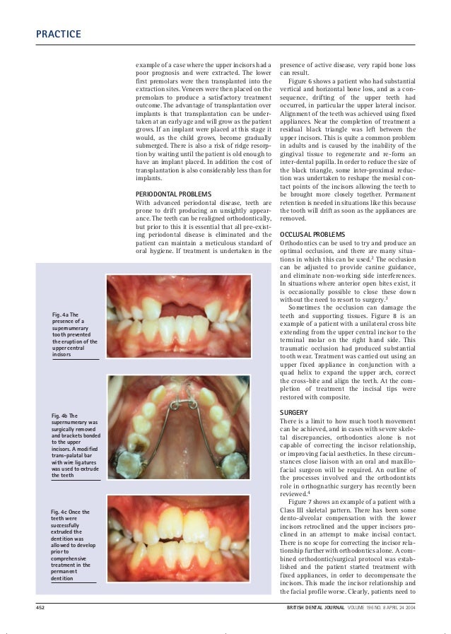 A clinical guide to orthodontics