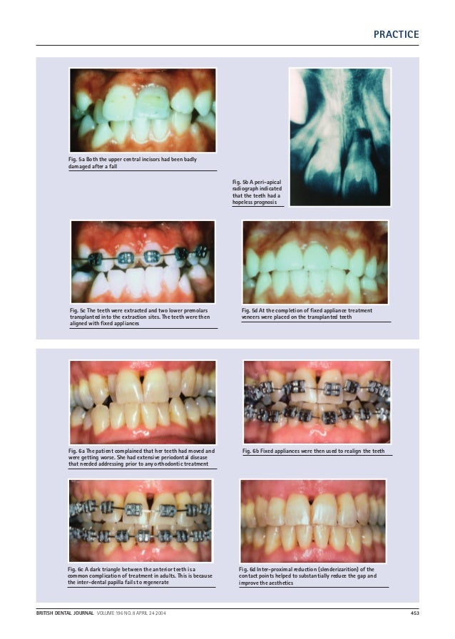 A clinical guide to orthodontics