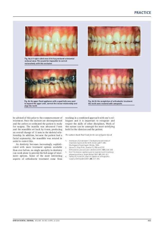 A clinical guide to orthodontics