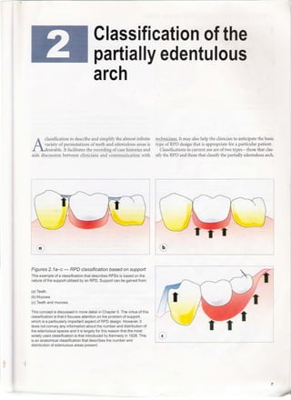 A clinical guide_to_removable_partial_denture_design | PDF