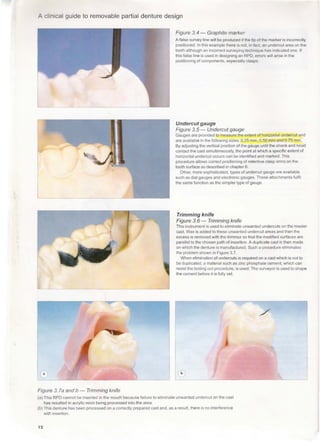 A clinical guide_to_removable_partial_denture_design | PDF