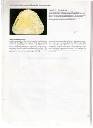 Denture Design Form A clinical guide_to_removable_partial_denture_design | PDF