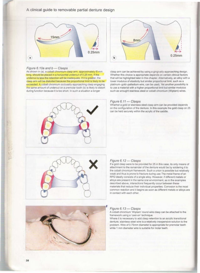 A clinical guide_to_removable_partial_denture_design