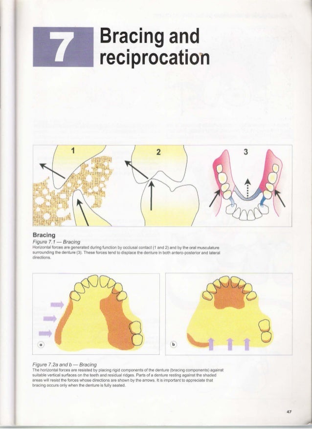 A clinical guide_to_removable_partial_denture_design
