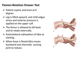 acl injuries.pptx