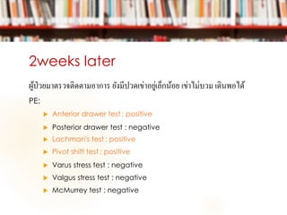 2weeks later
ผู้ป่วยมาตรวจติดตามอาการ ยังมีปวดเข่าอยู่เล็กน้อย เข่าไม่บวม เดินพอได้
PE:
 Anterior drawer test : positive
 Posterior drawer test : negative
 Lachman's test : positive
 Pivot shift test : positive
 Varus stress test : negative
 Valgus stress test : negative
 McMurrey test : negative
 