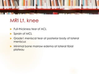 MRI Lt. knee
 Full-thickness tear of ACL
 Sprain of MCL
 Grade1 meniscal tear at posterior body of lateral
meniscus
 Minimal bone marrow edema at lateral tibial
plateau
 