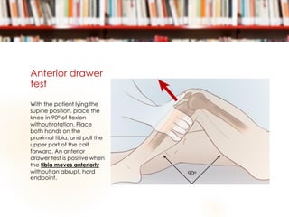 Anterior drawer
test
With the patient lying the
supine position, place the
knee in 90° of flexion
without rotation. Place
both hands on the
proximal tibia, and pull the
upper part of the calf
forward. An anterior
drawer test is positive when
the tibia moves anteriorly
without an abrupt, hard
endpoint.
 