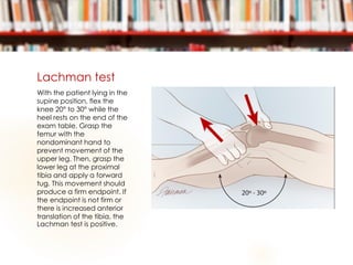 Lachman test
With the patient lying in the
supine position, flex the
knee 20° to 30° while the
heel rests on the end of the
exam table. Grasp the
femur with the
nondominant hand to
prevent movement of the
upper leg. Then, grasp the
lower leg at the proximal
tibia and apply a forward
tug. This movement should
produce a firm endpoint. If
the endpoint is not firm or
there is increased anterior
translation of the tibia, the
Lachman test is positive.
 