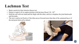 • Better sensitivity than Anterior drawer test
• Patient is made to lie in supine position with the knee flexed 20 - 30 ⁰
• Hold the calf with one hand and the thigh with the other, and try to displace the joint backwards
and forwards.
• The test is said to be Positive if the tibia moves forward more than that of the uninjured leg or if
the end point feels soft or absent .
 