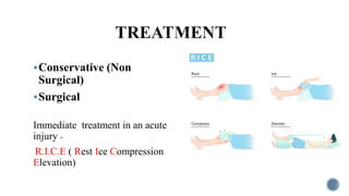 Conservative (Non
Surgical)
Surgical
Immediate treatment in an acute
injury -
R.I.C.E ( Rest Ice Compression
Elevation)
 