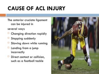 CAUSE OF ACL INJURY
The anterior cruciate ligament
can be injured in
several ways
 Changing direction rapidly
 Stopping suddenly
 Slowing down while running
 Landing from a jump
incorrectly
 Direct contact or collision,
such as a football tackle
 