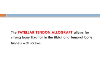 The PATELLAR TENDON ALLOGRAFT allows for
strong bony fixation in the tibial and femoral bone
tunnels with screws.
 