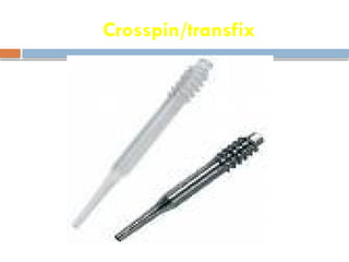 Crosspin/transfix
 