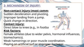 Non Contact Injuries Examples ACL INJURY IT'S MOI AND MANAGEMENT .pptx