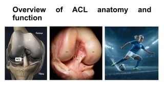 ACL RECONSTRUCTION AND CONTROVERSIES JOURNAL CLUB.pptx