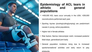 ACL RECONSTRUCTION AND CONTROVERSIES JOURNAL CLUB.pptx