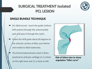 Pcl Inlay ACL & PCL Reconstruction Procedure..pptx