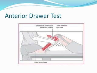 Anterior Drawer Test
 