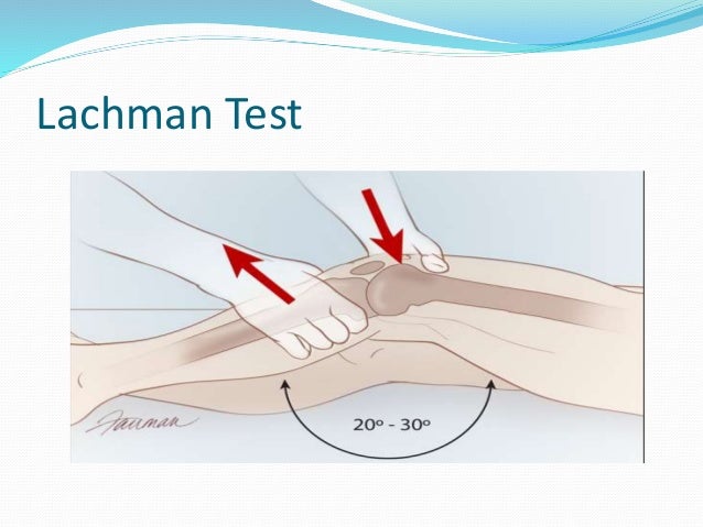 Acl Ppt