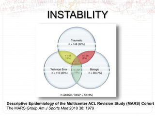 INSTABILITY
Descriptive Epidemiology of the Multicenter ACL Revision Study (MARS) Cohort
The MARS Group Am J Sports Med 2010 38: 1979
 